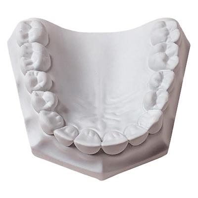 Whipmix - Orthodontic Stone 33lb