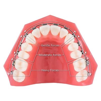 Ortho - Trifecta NiTi Archwire